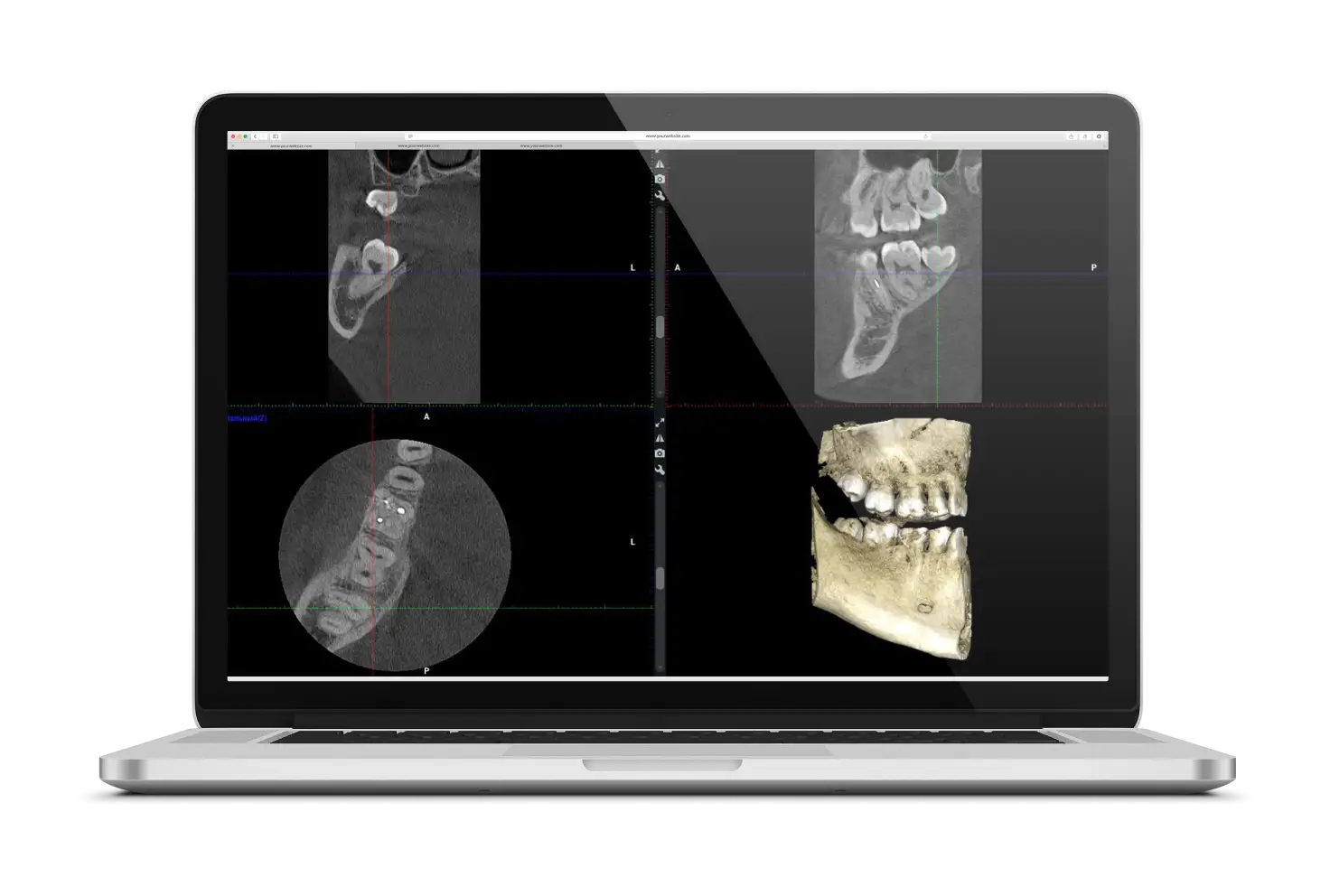3D CT, segment